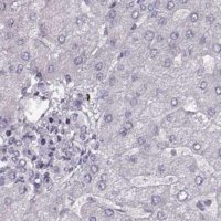 Anti-RP1L1 antibody produced in rabbit 