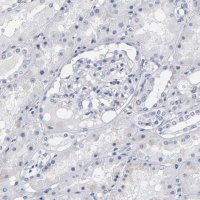 Anti-RPH3A antibody produced in rabbit 