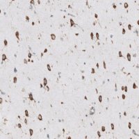 Anti-RPLP1 antibody produced in rabbit 