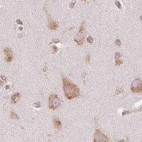 Anti-RPN1 antibody produced in rabbit HPA051520-100UL