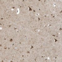 Anti-RPP40 antibody produced in rabbit 