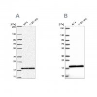 Anti-RPS15 antibody produced in rabbit 