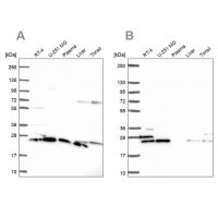 Anti-RPS5 antibody produced in rabbit HPA061979-100UL