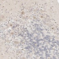 Anti-RPS6KL1 antibody produced in rabbit 