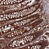 Anti-RPUSD1 antibody produced in rabbit 