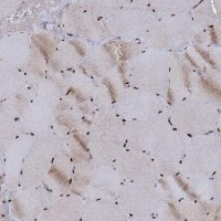 Anti-RPUSD4 antibody produced in rabbit 