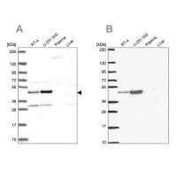 Anti-RRS1 antibody produced in rabbit HPA060937-100UL
