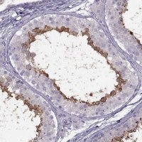 Anti-RSPH6A antibody produced in rabbit 