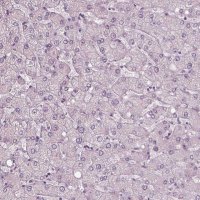 Anti-RSPH9 antibody produced in rabbit 