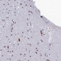 Anti-RSRC1 antibody produced in rabbit 