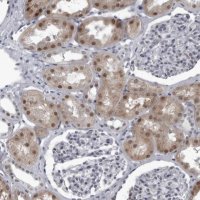 Anti-RTCA antibody produced in rabbit HPA027982-100UL