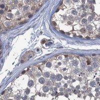 Anti-RTKN2 antibody produced in rabbit 