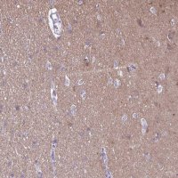 Anti-RTN1 antibody produced in rabbit 