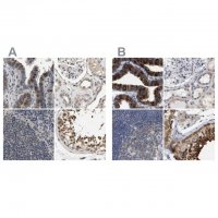 Anti-RUVBL1 antibody produced in rabbit 