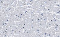 Anti-Ryanodine Receptor 2 Antibody, clone 2K6 ZooMAb Rabbit Monoclonal 