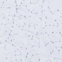 Anti-RYR2 antibody produced in rabbit 