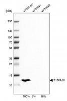 Anti-S100A16 antibody produced in rabbit 