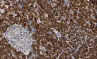 Anti-S6 Ribosomal Protein Antibody, clone 1E9, ZooMAb Rabbit Monoclonal 