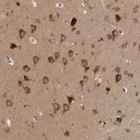 Anti-SAMD12 antibody produced in rabbit 