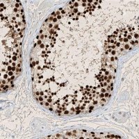 Anti-SAMD15 antibody produced in rabbit 
