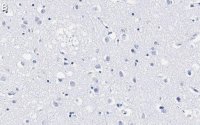 Anti-SATB2 Antibody, clone 1H17 ZooMAb Rabbit Monoclonal 
