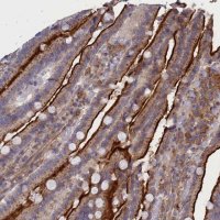 Anti-SCAMP4 antibody produced in rabbit HPA043284-100UL
