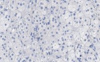 Anti-SCARB1 Antibody, clone 3B15 ZooMAb Rabbit Monoclonal 