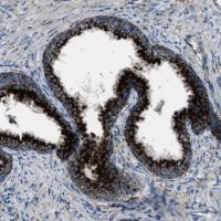 Anti-SCARB2 antibody produced in rabbit 