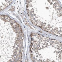 Anti-SCFD2 antibody produced in rabbit 