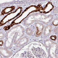 Anti-SCIN antibody produced in rabbit 