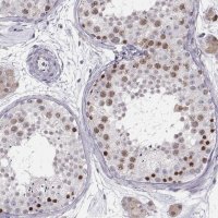 Anti-SCML2 antibody produced in rabbit 