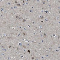 Anti-SCN4B antibody produced in rabbit HPA017293-100UL