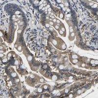 Anti-SCNN1B antibody produced in rabbit 