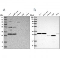 Anti-SCO1 antibody produced in rabbit 