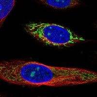 Anti-SDHA antibody produced in rabbit 