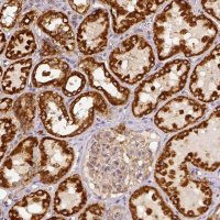 Anti-SDHB antibody produced in rabbit 
