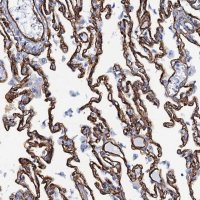 Anti-SDPR antibody produced in rabbit 