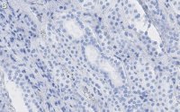 Anti-Selenoprotein P Antibody, clone 2G23 ZooMAb Rabbit Monoclonal 