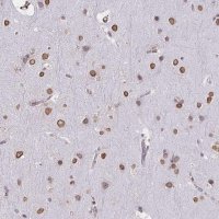 Anti-SEMA6B antibody produced in rabbit 