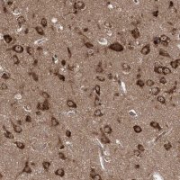 Anti-SERINC1 antibody produced in rabbit HPA035738-100UL