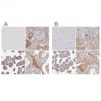 Anti-SERPINA1 antibody produced in rabbit 