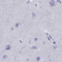 Anti-SERPINA3 antibody produced in rabbit 