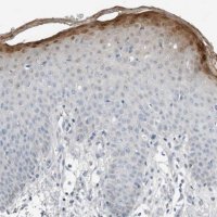 Anti-SERPINB7 antibody produced in rabbit 