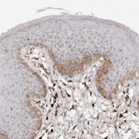 Anti-SERPINH1 antibody produced in rabbit HPA029198-100UL
