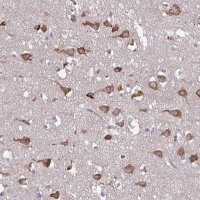 Anti-SERPINI1 antibody produced in rabbit 