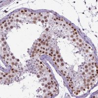 Anti-SETD1A antibody produced in rabbit 