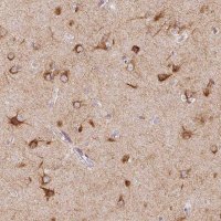 Anti-SEZ6L2 antibody produced in rabbit 