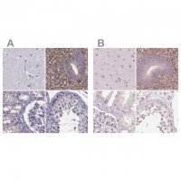 Anti-SFRP4 antibody produced in rabbit 