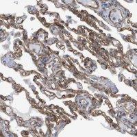 Anti-SGMS2 antibody produced in rabbit 