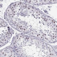 Anti-SGO1 antibody produced in rabbit 